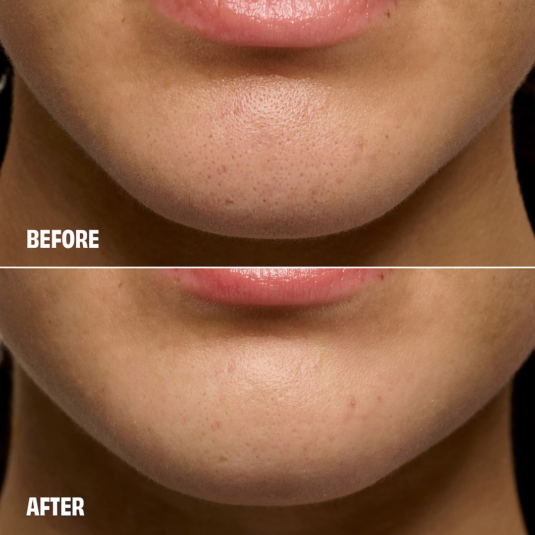 BENEFIT COSMETICS The POREfessional Degunker - Maschera viso per pulizia pori e punti neri