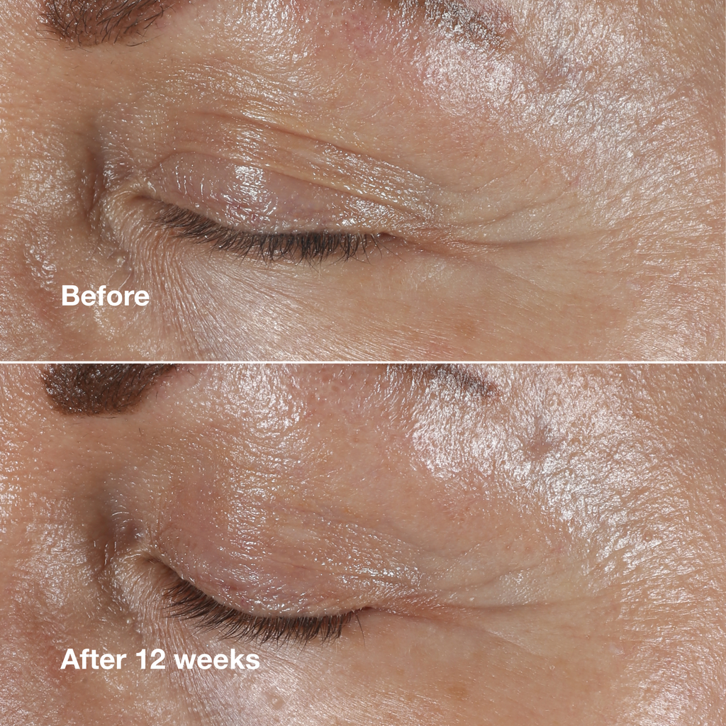 Clinique Smart Clinical Repair™ Wrinkle Correcting Eye Cream