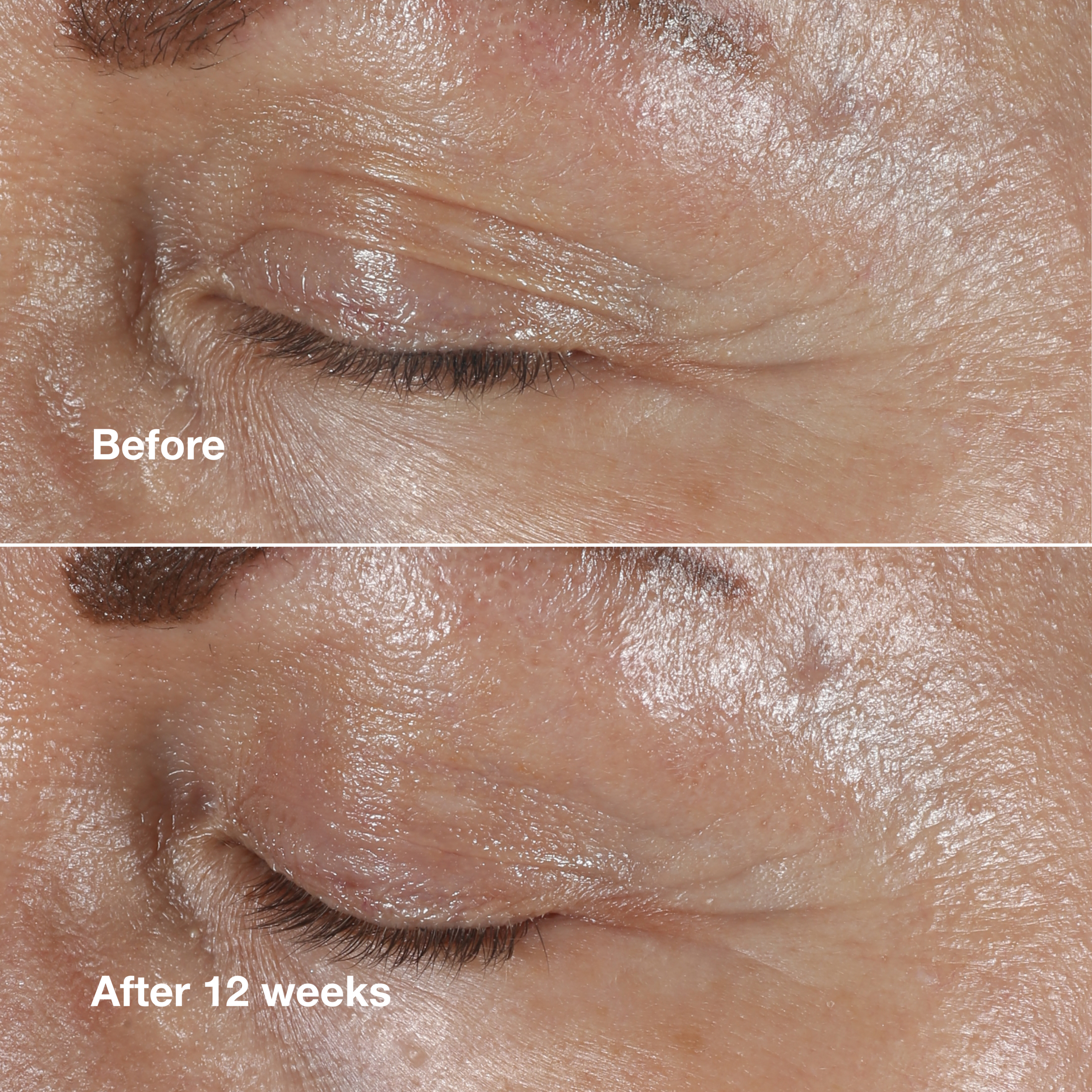 Clinique Smart Clinical Repair™ Wrinkle Correcting Eye Cream